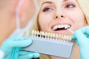 Tips to Care for Porcelain Veneers